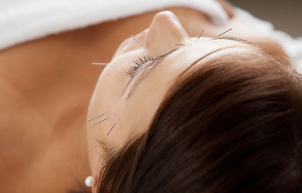 An Introduction to Cosmetic Facial Acupunture | WEBINAR