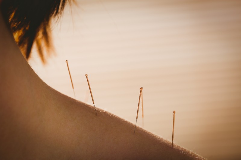 Acupuncture Women