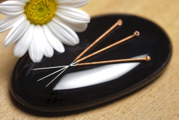 Acupuncture for Endometriosis