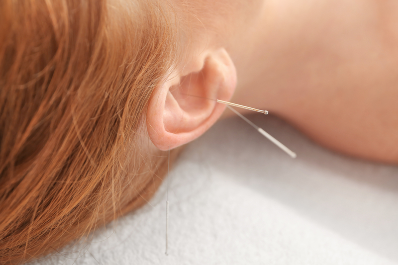 Auricular (Ear) Acupuncture Streeterville Chicago | Free Event